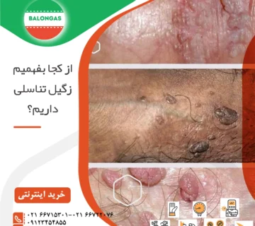 از کجا بفهمم زگیل تناسلی دارم