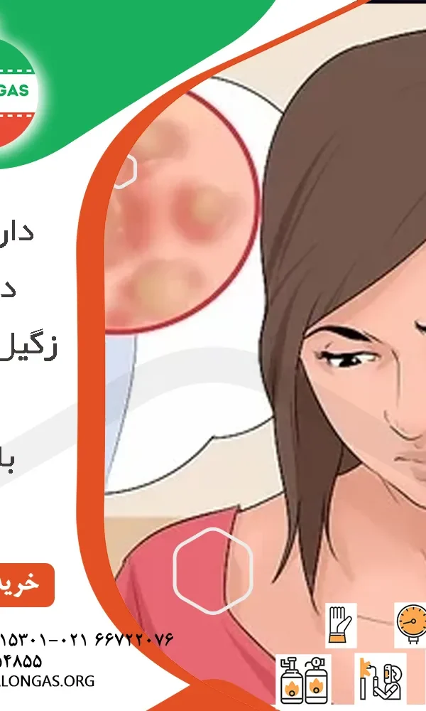 دارو برای درمان زگیل تناسلی بانوان